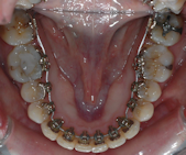 traitement orthodontie créteil